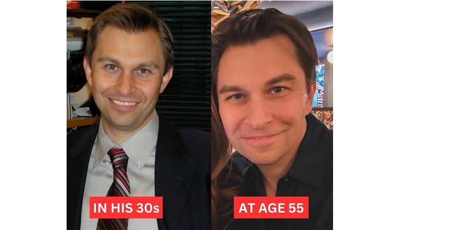 dr sinclair reverse aging