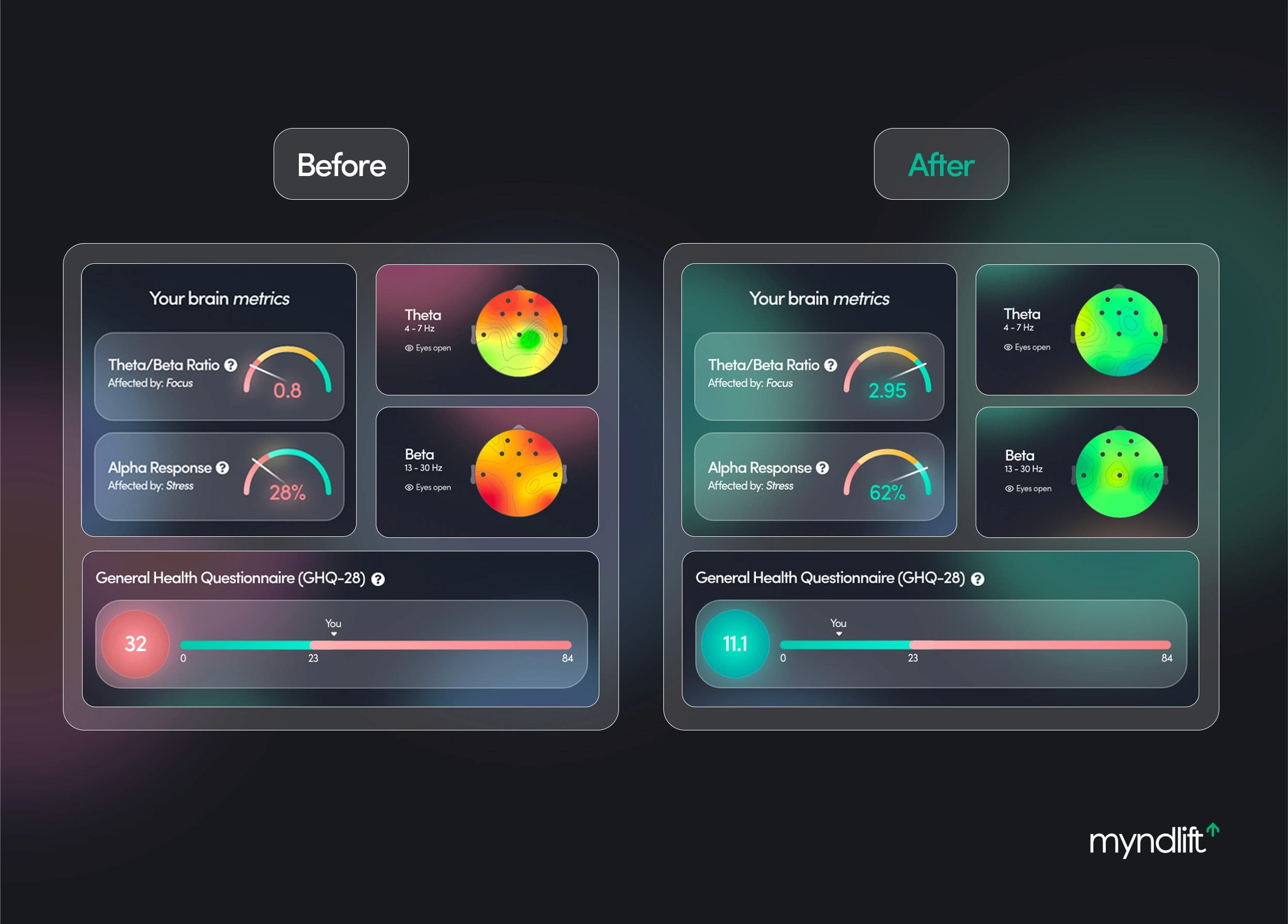 muse neurofeedback device