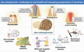 does vibration therapy improve osteoporosis