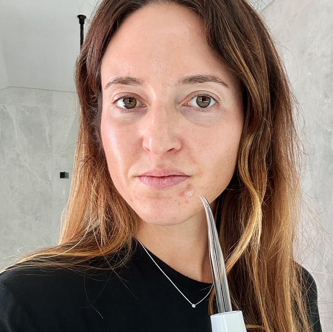 nuderma portable handheld high frequency skin therapy wand machine reviews