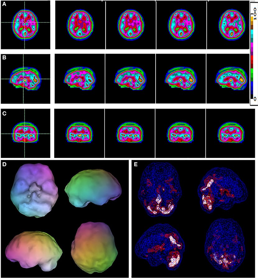 ao scan research