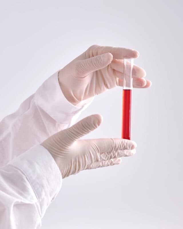 The Reddit Biohacking Process 1 reddit biohacking