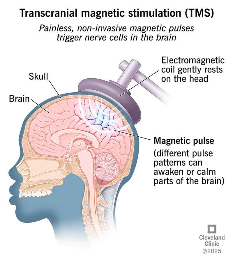 Low Frequency Pulse Therapy 1 low frequency pulse therapy