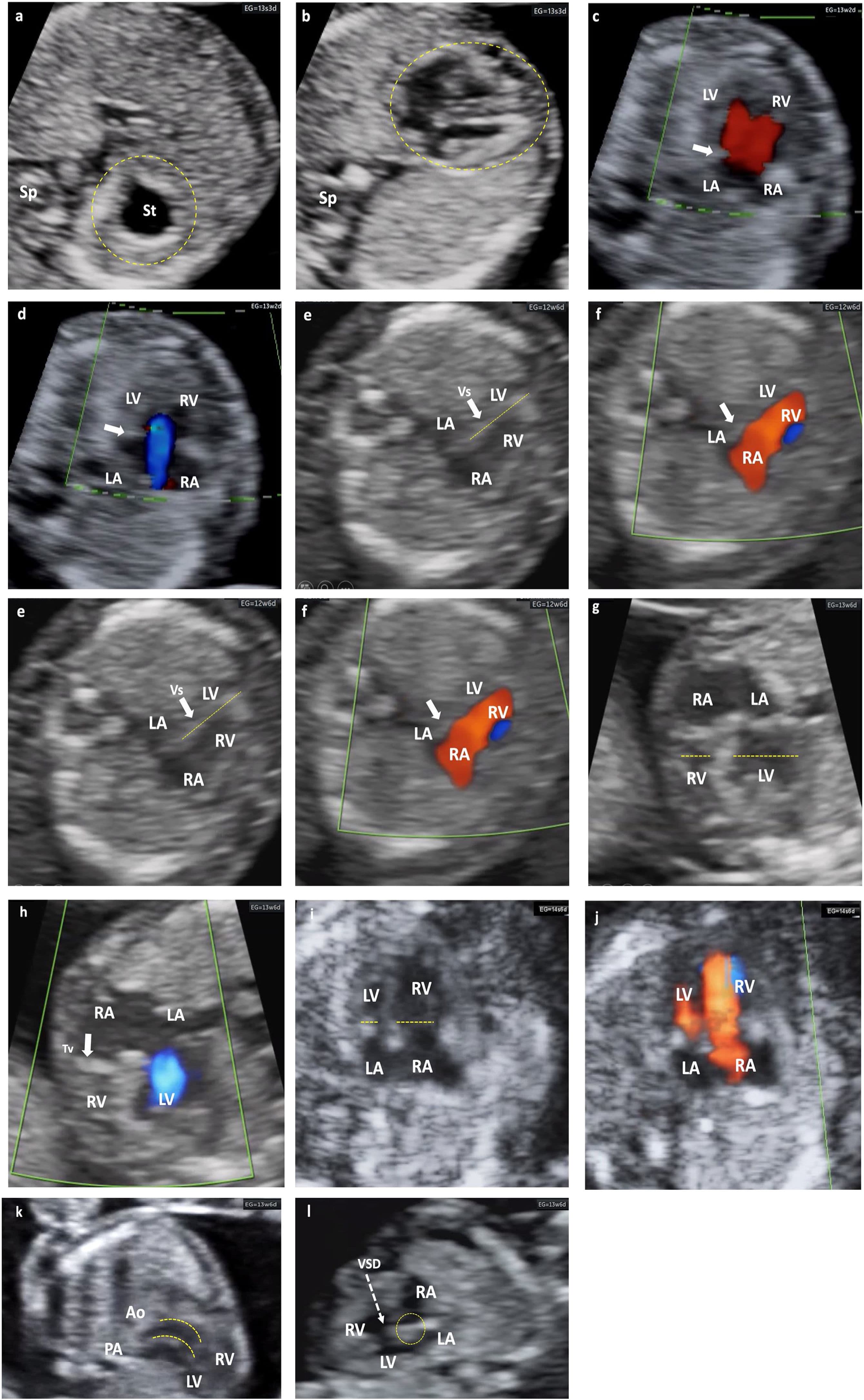 Infection Prevention and Control in Ultrasound 1 ao ultrasound meaning