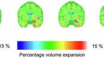 Finding Frequency Therapy For Depression 1 frequency therapy for depression