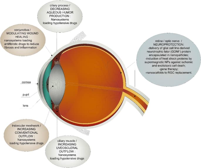 Glaucoma Alternative Therapy 1 glaucoma alternative therapy